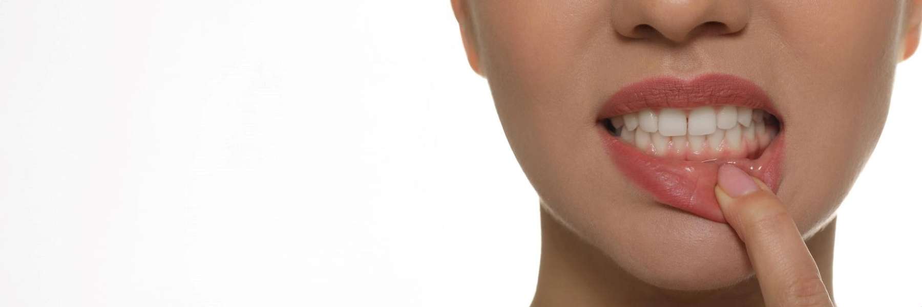 Gum Disease Treatment | Dentist